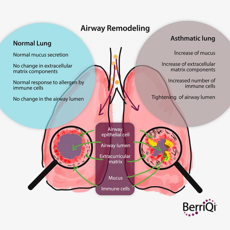 What do COVID, COPD, Asthma & IPF have in common? | BerriQi®